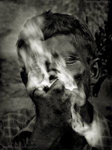 Man suffering from leprosy, Varanasi, India 2007